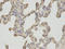 O-Linked N-Acetylglucosamine (GlcNAc) Transferase antibody, LS-B13864, Lifespan Biosciences, Immunohistochemistry frozen image 