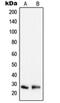 Peroxiredoxin 3 antibody, orb215027, Biorbyt, Western Blot image 