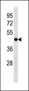 Olfactomedin 3 antibody, PA5-49313, Invitrogen Antibodies, Western Blot image 