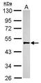 Plasminogen Activator, Urokinase antibody, PA5-34638, Invitrogen Antibodies, Western Blot image 