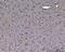 ABL Proto-Oncogene 2, Non-Receptor Tyrosine Kinase antibody, PB9913, Boster Biological Technology, Immunohistochemistry paraffin image 