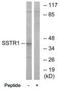 Somatostatin Receptor 1 antibody, TA326147, Origene, Western Blot image 