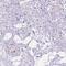 DCC Netrin 1 Receptor antibody, NBP2-49606, Novus Biologicals, Immunohistochemistry paraffin image 