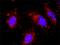 RuvB Like AAA ATPase 1 antibody, H00008607-M01, Novus Biologicals, Proximity Ligation Assay image 