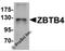 Zinc Finger And BTB Domain Containing 4 antibody, 6121, ProSci, Western Blot image 