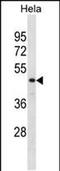 N-Myc Downstream Regulated 1 antibody, PA5-48411, Invitrogen Antibodies, Western Blot image 