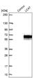 Lecithin-Cholesterol Acyltransferase antibody, NBP2-76537, Novus Biologicals, Western Blot image 