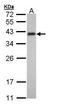 Tropomyosin 2 antibody, GTX109268, GeneTex, Western Blot image 