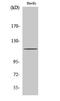 Protein Kinase D1 antibody, STJ95136, St John