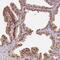 Polyhomeotic Homolog 2 antibody, PA5-61504, Invitrogen Antibodies, Immunohistochemistry frozen image 