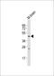 Solute Carrier Family 16 Member 11 antibody, 55-505, ProSci, Western Blot image 