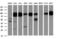 Interferon Induced Protein With Tetratricopeptide Repeats 1 antibody, GTX84315, GeneTex, Western Blot image 