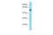 Negative Elongation Factor Complex Member A antibody, PA5-70518, Invitrogen Antibodies, Western Blot image 