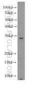 Ribonuclease A Family Member 11 (Inactive) antibody, 17203-1-AP, Proteintech Group, Western Blot image 