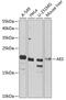 Amino-terminal enhancer of split antibody, GTX32426, GeneTex, Western Blot image 