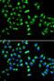 Polypeptide N-Acetylgalactosaminyltransferase 2 antibody, LS-C346137, Lifespan Biosciences, Immunofluorescence image 