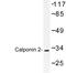 Calponin 2 antibody, LS-C177356, Lifespan Biosciences, Western Blot image 