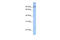 ClpB Homolog, Mitochondrial AAA ATPase Chaperonin antibody, 26-831, ProSci, Enzyme Linked Immunosorbent Assay image 