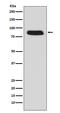 Colony Stimulating Factor 3 Receptor antibody, M00281, Boster Biological Technology, Western Blot image 