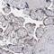Perilipin 1 antibody, PA5-55046, Invitrogen Antibodies, Immunohistochemistry frozen image 