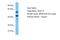 Nudix Hydrolase 19 antibody, A14864, Boster Biological Technology, Western Blot image 