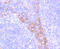 Integrin Subunit Beta 4 antibody, GTX01053, GeneTex, Immunohistochemistry paraffin image 