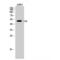 C-Terminal Src Kinase antibody, LS-C382924, Lifespan Biosciences, Western Blot image 