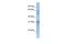 Mitochondrial Carrier 2 antibody, GTX45343, GeneTex, Western Blot image 