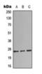 Complement C1q B Chain antibody, orb393227, Biorbyt, Western Blot image 