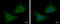 Rab Geranylgeranyltransferase Subunit Beta antibody, GTX105874, GeneTex, Immunocytochemistry image 