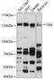 Neurotrophic Receptor Tyrosine Kinase 2 antibody, 18-499, ProSci, Western Blot image 
