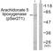 Arachidonate 5-Lipoxygenase antibody, PA5-38408, Invitrogen Antibodies, Western Blot image 