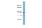 Aspartate Beta-Hydroxylase Domain Containing 2 antibody, A16061, Boster Biological Technology, Western Blot image 