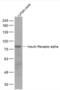 Insulin Like Growth Factor 1 Receptor antibody, orb10923, Biorbyt, Western Blot image 