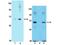 P21 (RAC1) Activated Kinase 1 antibody, NBP2-29665, Novus Biologicals, Western Blot image 