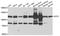 Aconitase 1 antibody, A7867, ABclonal Technology, Western Blot image 