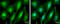 Protein Kinase C Alpha antibody, GTX130453, GeneTex, Immunofluorescence image 