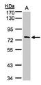 Tetratricopeptide Repeat Domain 30A antibody, GTX107359, GeneTex, Western Blot image 
