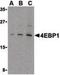 Eukaryotic Translation Initiation Factor 4E Binding Protein 1 antibody, PA5-20135, Invitrogen Antibodies, Western Blot image 