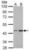 Charged Multivesicular Body Protein 2B antibody, orb167313, Biorbyt, Western Blot image 