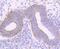 CD99 Molecule (Xg Blood Group) antibody, NBP2-67019, Novus Biologicals, Immunohistochemistry paraffin image 