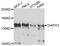 Diaphanous Related Formin 3 antibody, A10351, ABclonal Technology, Western Blot image 