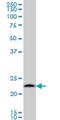 Proteasome Subunit Beta 6 antibody, H00005694-M02, Novus Biologicals, Western Blot image 