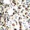 Checkpoint Kinase 2 antibody, LS-C358943, Lifespan Biosciences, Immunohistochemistry paraffin image 