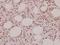 Progastricsin antibody, A00218, Boster Biological Technology, Immunohistochemistry paraffin image 