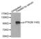 Protein Tyrosine Kinase 2 Beta antibody, LS-C335877, Lifespan Biosciences, Western Blot image 