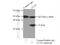 Clathrin Light Chain A antibody, 10852-1-AP, Proteintech Group, Immunoprecipitation image 