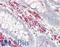 Septin 6 antibody, LS-B12503, Lifespan Biosciences, Immunohistochemistry paraffin image 
