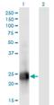 MID1 Interacting Protein 1 antibody, H00058526-M01, Novus Biologicals, Western Blot image 