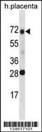 Serine Peptidase Inhibitor, Kunitz Type 1 antibody, 58-209, ProSci, Western Blot image 